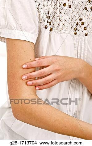 Hand of young woman scratching her arm, suffering from a rash View Large Photo Image Picture - Hand of young woman scratching her arm, suffering from a rash. Fotosearch