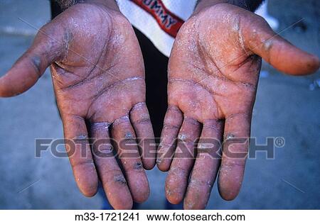 Hands of drummer in Hamel street HAVANA Cuba View Large Photo Image Stock Image - Hands of drummer in Hamel street HAVANA Cuba. Fotosearch