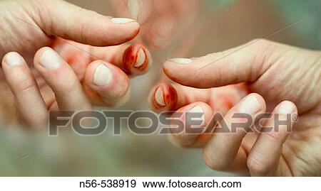 Hands stained with blood. View Large Photo Image Stock Photo - Hands stained with blood.. Fotosearch