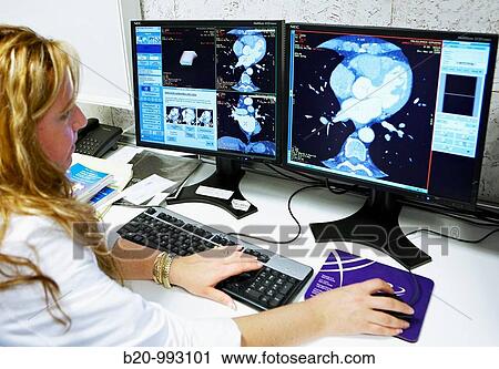 Stock Image - HD(high-definition) scan of heart, CAT, medical imaging for diagnosis. Hospital Policlinica Gipuzkoa, San Sebastian, Donostia, Euskadi, Spain. Fotosearch