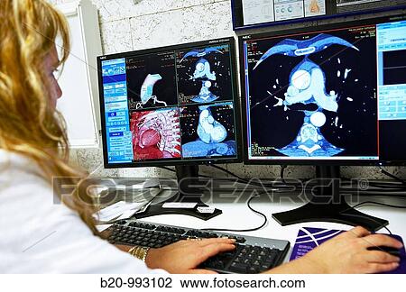 HD(high-definition) scan of heart, CAT, medical imaging for diagnosis. Hospital Policlinica Gipuzkoa, San Sebastian, Donostia, Euskadi, Spain View Large Photo Image Stock Image - HD(high-definition) scan of heart, CAT, medical imaging for diagnosis. Hospital Policlinica Gipuzkoa, San Sebastian, Donostia, Euskadi, Spain. Fotosearch