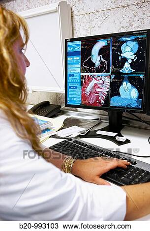 HD(high-definition) scan of heart, CAT, medical imaging for diagnosis. Hospital Policlinica Gipuzkoa, San Sebastian, Donostia, Euskadi, Spain View Large Photo Image Stock Image - HD(high-definition) scan of heart, CAT, medical imaging for diagnosis. Hospital Policlinica Gipuzkoa, San Sebastian, Donostia, Euskadi, Spain. Fotosearch