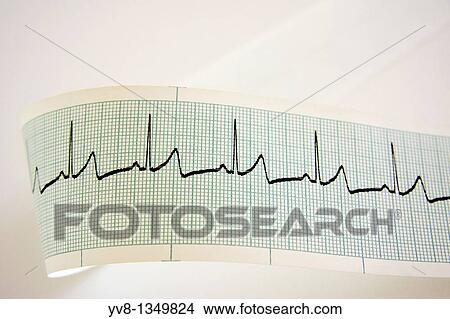 Heart rate monitoring View Large Photo Image Picture - Heart rate monitoring. Fotosearch
