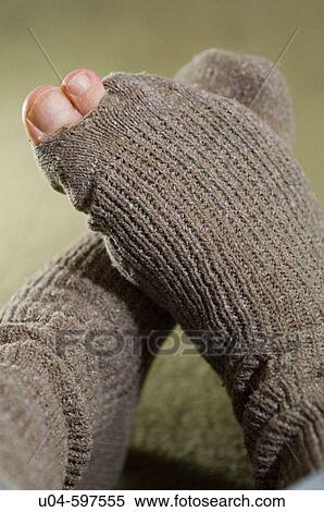Hole in sock View Large Photo Image Stock Photography - Hole in sock. Fotosearch