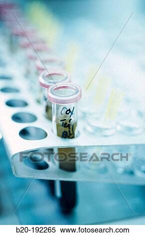 Hospital lab View Large Photo Image Stock Photography - Hospital lab. Fotosearch