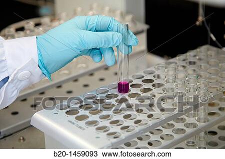 HPLC-MS (High Performance Liquid Chromatography-Mass Spectrometry), Analysis Lab, IkerChem research lab, design and synthesis of new chemical entities with therapeutic applications in oncology View Large Photo Image Stock Image - HPLC-MS (High Performance Liquid Chromatography-Mass Spectrometry), Analysis Lab, IkerChem research lab, design and synthesis of new chemical entities with therapeutic applications in oncology. Fotosearch