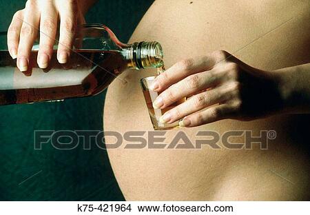 Picture - Illustration: alcohol abuse while pregnant. Fotosearch