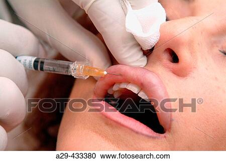 Stock Image - Injection hyacuronic acid.. Fotosearch