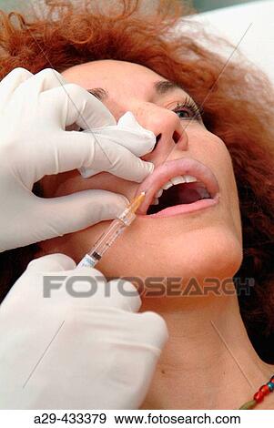 Injection hyaluronic acid. View Large Photo Image Stock Photo - Injection hyaluronic acid.. Fotosearch