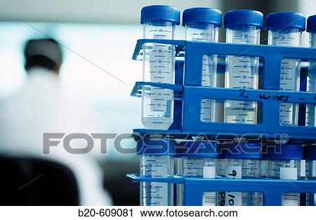 Laboratory, urine test View Large Photo Image Stock Image - Laboratory, urine test. Fotosearch