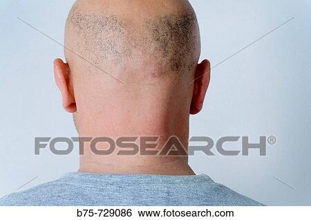 Man View Large Photo Image Stock Photograph - Man. Fotosearch
