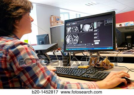 Stock Photo - Medical images such as MRI processing techniques, Segmentation, Analysis and Diagnosis, Internet of Things lab, Tecnalia Research & Innovation, Zamudio, Bizkaia, Euskadi, Spain. Fotosearch