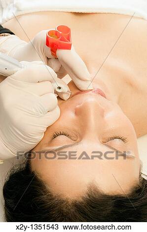 Micropigmentation procedure for the lips, permanent make-up View Large Photo Image Stock Image - Micropigmentation procedure for the lips, permanent make-up. Fotosearch