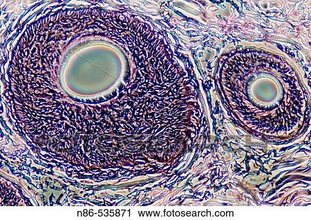 Stock Image - Microscopy, biological. Fotosearch