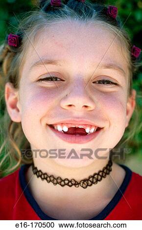 Missing teeth View Large Photo Image Stock Image - Missing teeth. Fotosearch