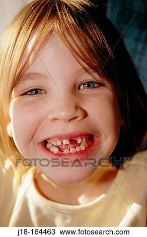 Missing teeth View Large Photo Image Stock Image - Missing teeth. Fotosearch