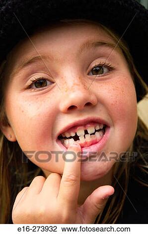 missing tooth View Large Photo Image Stock Image - missing tooth. Fotosearch