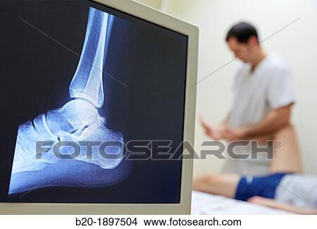 Mobilization passive inversion of the ankle, ankle X-ray image Physiotherapy medical center, Donostia, San Sebastian, Gipuzkoa, Basque Country, Spain View Large Photo Image Picture - Mobilization passive inversion of the ankle, ankle X-ray image Physiotherapy medical center, Donostia, San Sebastian, Gipuzkoa, Basque Country, Spain. Fotosearch