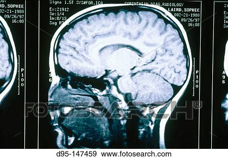 MRI brain scan View Large Photo Image Stock Photo - MRI brain scan. Fotosearch