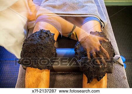 Mud therapy. Caldes de Boi Spa, Bo? valley. Lleida province. Catalonia. Spain. View Large Photo Image Stock Photo - Mud therapy. Caldes de Boi Spa, Bo? valley. Lleida province. Catalonia. Spain.. Fotosearch
