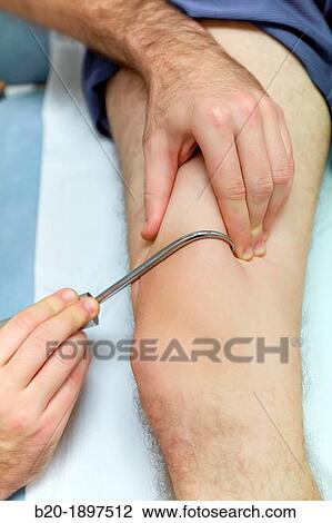 Myofascial fibrolysis instrumental hook in quadriceps Physiotherapy medical center, Donostia, San Sebastian, Gipuzkoa, Basque Country, Spain View Large Photo Image Stock Image - Myofascial fibrolysis instrumental hook in quadriceps Physiotherapy medical center, Donostia, San Sebastian, Gipuzkoa, Basque Country, Spain. Fotosearch