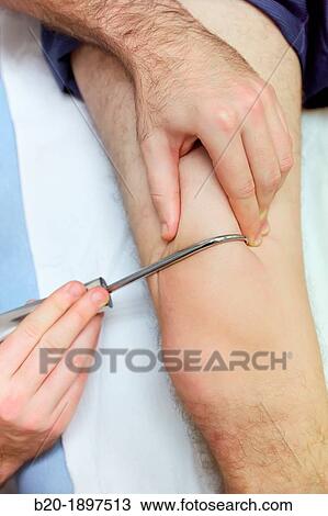 Myofascial fibrolysis instrumental hook in quadriceps Physiotherapy medical center, Donostia, San Sebastian, Gipuzkoa, Basque Country, Spain View Large Photo Image Stock Image - Myofascial fibrolysis instrumental hook in quadriceps Physiotherapy medical center, Donostia, San Sebastian, Gipuzkoa, Basque Country, Spain. Fotosearch