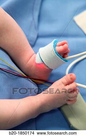 Neonate, Neonate Intensive care Unit, Donostia Hospital, San Sebastian, Donostia, Gipuzkoa, Basque Country, Spain View Large Photo Image Picture - Neonate, Neonate Intensive care Unit, Donostia Hospital, San Sebastian, Donostia, Gipuzkoa, Basque Country, Spain. Fotosearch