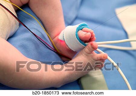 Neonate, Neonate Intensive care Unit, Donostia Hospital, San Sebastian, Donostia, Gipuzkoa, Basque Country, Spain View Large Photo Image Stock Image - Neonate, Neonate Intensive care Unit, Donostia Hospital, San Sebastian, Donostia, Gipuzkoa, Basque Country, Spain. Fotosearch