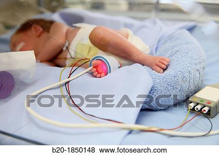 Neonate, Neonate Intensive care Unit, Donostia Hospital, San Sebastian, Donostia, Gipuzkoa, Basque Country, Spain View Large Photo Image Stock Photo - Neonate, Neonate Intensive care Unit, Donostia Hospital, San Sebastian, Donostia, Gipuzkoa, Basque Country, Spain. Fotosearch