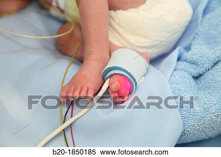 Neonate, Neonate Intensive Care Unit, Donostia Hospital, San Sebastian, Donostia, Gipuzkoa, Basque Country, Spain View Large Photo Image Stock Photography - Neonate, Neonate Intensive Care Unit, Donostia Hospital, San Sebastian, Donostia, Gipuzkoa, Basque Country, Spain. Fotosearch