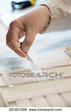 Stock Photo - Neuropharmacology, IIBB - Institute for Biomedical Research of Barcelona, CSIC - Consejo Superior de Investigacion Cientifica (Spanish National Research Council), Barcelona, Catalonia, Spain. Fotosearch