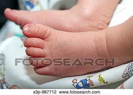 Stock Image - Newborn feet. Fotosearch
