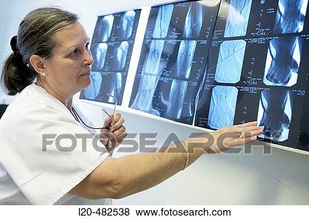 Nurse looking to CAT (Computerized Axial Tomography) images, Neurosurgery department. Hospital Universitario Gran Canaria Doctor Negrin, Las Palmas de Gran Canaria. Canary Islands, Spain View Large Photo Image Stock Photo - Nurse looking to CAT (Computerized Axial Tomography) images, Neurosurgery department. Hospital Universitario Gran Canaria Doctor Negrin, Las Palmas de Gran Canaria. Canary Islands, Spain. Fotosearch