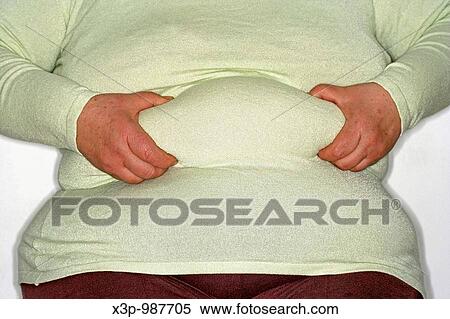Obese woman View Large Photo Image Stock Photography - Obese woman. Fotosearch