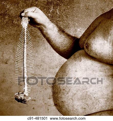Obesity and fishbone. View Large Photo Image Stock Image - Obesity and fishbone.. Fotosearch