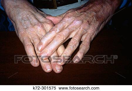 Stock Photography - Old man's hand. Fotosearch