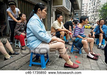 People being treated with traditional medicine and Acupuncture on the street, Chongqing, Sichuan Province, Yangtze River, China. View Large Photo Image Stock Image - People being treated with traditional medicine and Acupuncture on the street, Chongqing, Sichuan Province, Yangtze River, China.. Fotosearch