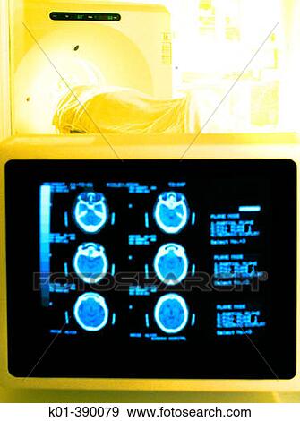 Person going into a Cat Scan or MRI machine with computer screen in the foreground. View Large Photo Image Stock Photo - Person going into a Cat Scan or MRI machine with computer screen in the foreground.. Fotosearch