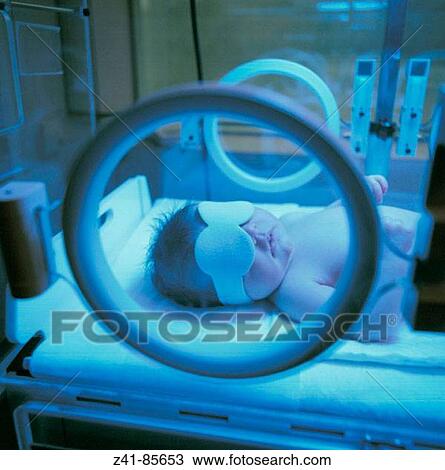 Phototherapy at intensive care nursery View Large Photo Image Stock Image - Phototherapy at intensive care nursery. Fotosearch