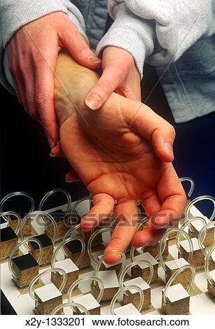 Physical therapist with stroke patient working on motor skills at a peg board Occupational threapy View Large Photo Image Stock Image - Physical therapist with stroke patient working on motor skills at a peg board Occupational threapy. Fotosearch