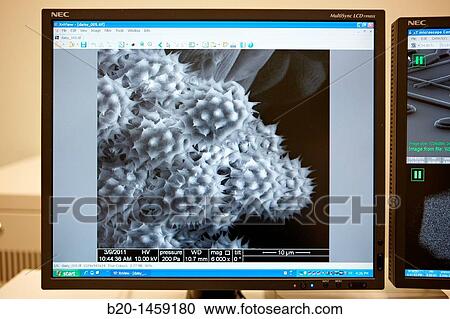 Polen images on SEM, Analysis of nanostructures and nanodevices, Environmental scanning electron microscopy Laboratory, ESEM, Microscope Quanta TM 250 FEG, High-resolution surface imaging, Investigation of wet and dielectric samples View Large Photo Image Stock Image - Polen images on SEM, Analysis of nanostructures and nanodevices, Environmental scanning electron microscopy Laboratory, ESEM, Microscope Quanta TM 250 FEG, High-resolution surface imaging, Investigation of wet and dielectric samples. Fotosearch