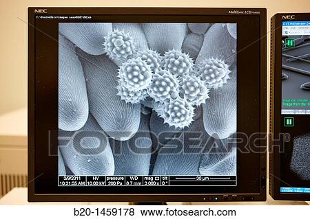 Polen images on SEM, Analysis of nanostructures and nanodevices, Environmental scanning electron microscopy Laboratory, ESEM, Microscope Quanta TM 250 FEG, High-resolution surface imaging, Investigation of wet and dielectric samples View Large Photo Image Stock Photo - Polen images on SEM, Analysis of nanostructures and nanodevices, Environmental scanning electron microscopy Laboratory, ESEM, Microscope Quanta TM 250 FEG, High-resolution surface imaging, Investigation of wet and dielectric samples. Fotosearch