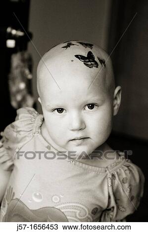 Portrait of a young girl with pediatric cancer leukaemia showing her butterfly tattos on her bald head She has recently lost her hair from the side effects of chemo therapy View Large Photo Image Stock Image - Portrait of a young girl with pediatric cancer leukaemia showing her butterfly tattos on her bald head She has recently lost her hair from the side effects of chemo therapy. Fotosearch