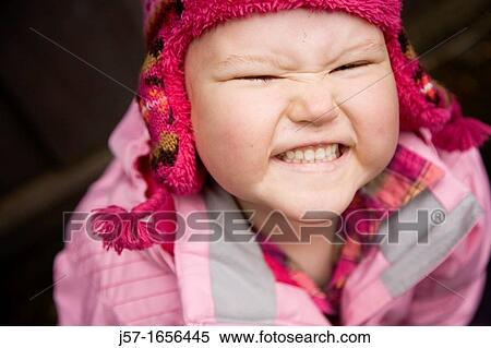 Stock Photography - Portrait of a young girl with pediatric cancer leukaemia smiling at the camera She has just lost her hair after a strong dose of chemo therapy but is still managing to smile and have fun She is also bloated from the side effects of Dexamethasone. Fotosearch
