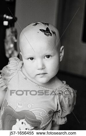 Stock Photography - Portrait of a young girl with pediatric cancer leukaemia showing her butterfly tattos on her bald head She has recently lost her hair from the side effects of chemo therapy. Fotosearch