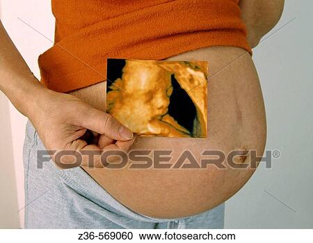 Pregnant woman with x-ray picture View Large Photo Image Stock Image - Pregnant woman with x-ray picture. Fotosearch