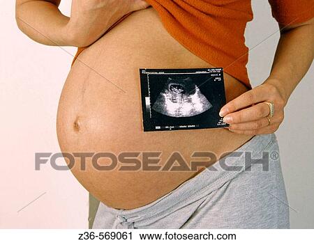 Pregnant woman with x-ray picture View Large Photo Image Stock Image - Pregnant woman with x-ray picture. Fotosearch