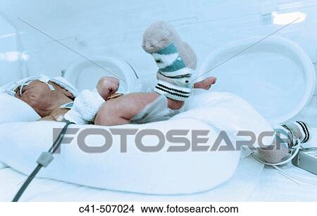 Premature baby View Large Photo Image Picture - Premature baby. Fotosearch