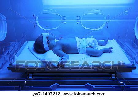 Stock Image - Premature baby with jaundice having phototherapy. Fotosearch