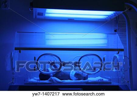 Premature baby with jaundice having phototherapy View Large Photo Image Stock Photo - Premature baby with jaundice having phototherapy. Fotosearch